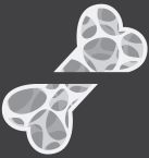 Bone scan illustration
